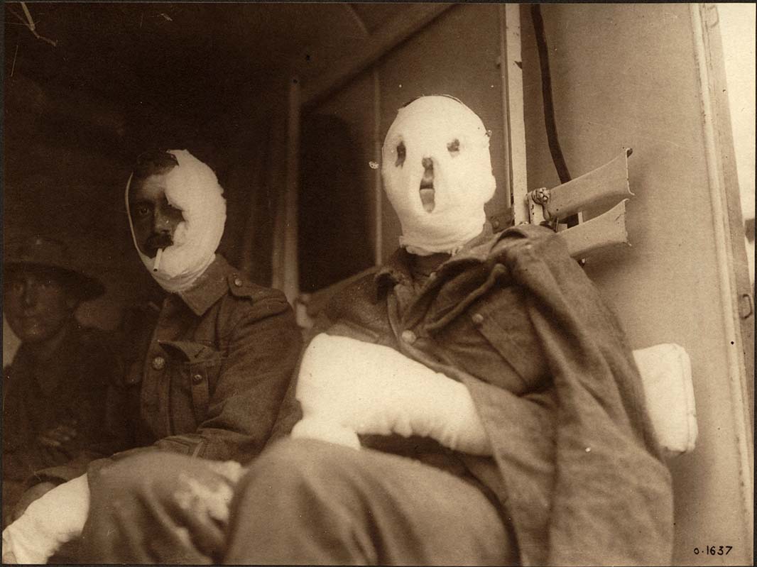 Frontiers in medical countermeasures against CBRN agents